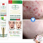 کرم ضدلک و سفیدکننده قوی آیچون بیوتی